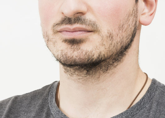 Why Is My Beard Patchy? Causes and What You Can Do About It