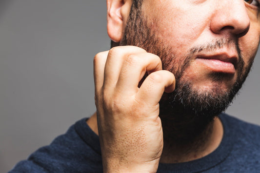 How to Stop Your Beard From Itching