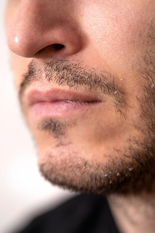 What Causes Beard Flaking and How to Fix It